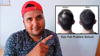 Hairfall and Hair Regrowth Treatment  Hairfall Control Best Homeopathicmedicines [upl. by Maclean405]