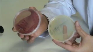 Técnicas básicas de Microbiología Morfología de Escherichia coli en diferentes medios de cultivo [upl. by Alracal758]