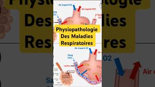 Physiopathologie Maladies Respiratoires pneumologie bronchite asthme fibrosepulmonaire poumon [upl. by Itnahs]