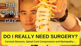 Cervical Stenosis Spinal Cord Compression and Myelopathy DO I REALLY NEED SURGERY [upl. by Neiv]