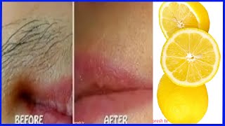 Unwanted hair removal for women naturally with lemon remedy  face hair removal for women at home [upl. by Youlton]