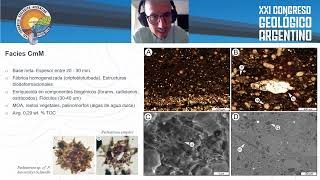 SEM study of mud aggregates within earlydiagenetic carbonate concretions [upl. by Bobseine]