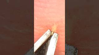 Satisfying splinter removal یکی از لذت shorts splinter dental بخش ترین صحنه 😍🤤ها [upl. by Yrovi]