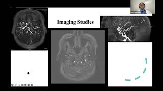 Sub Intern Case Presentations November 6th 2024 [upl. by Choo]