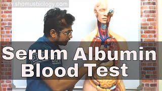 Serum albumin test in Hindi  Albumin blood test procedure [upl. by Eiznik]