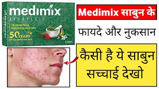 Medimix Soap Review In Hindi  medimix sabun ke fayde [upl. by Algar]