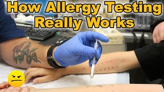 HOW TESTING FOR ALLERGIES REALLY WORKS [upl. by Uuge953]