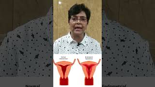 IUDHORMONAL CONTRACEPTION  MIRENA IUDmirenacontraceptives contraception shortsshortsvideo [upl. by Nalliuq]