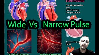 Narrow pulse pressure vs Wide Pulse pressure [upl. by Lugar932]