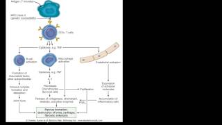 94P Pathogenesis of Rheumatoid Arthritis RA [upl. by Aneekas197]