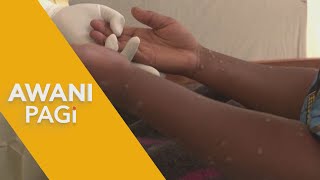 LANGSUNG AWANI Pagi Memahami vaksinasi mpox  8 Sept 2024 [upl. by Elyak]