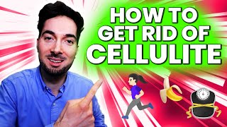 How To Get Rid Of Cellulite Treatment and Removal Medical Info [upl. by Kinna]