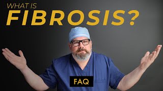 What Can You Do To Prevent FIBROSIS After Liposuction [upl. by Oiliruam270]