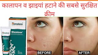 Bleminor anti blemish cream review in Hindi  झाइयां हटाए रंग निखारे [upl. by Aleil160]