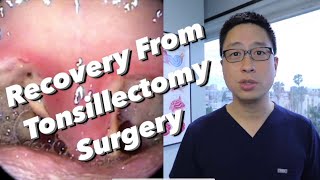 PostTonsillectomy Overview pain control diet bleeding concerns physical limitations [upl. by Damalus]