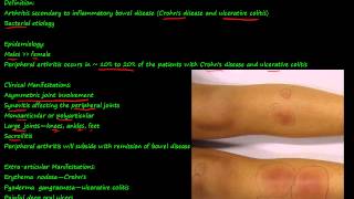 100P  Enteropathic Arthropathy [upl. by Oivaf]