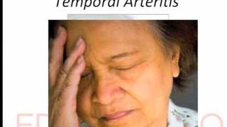 temporal arteritis [upl. by Aihtnys]