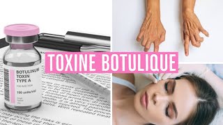 TOXINE BOTULIQUE  INJECTION VISAGE  RIDES  SPASTICITE [upl. by Ebbie632]