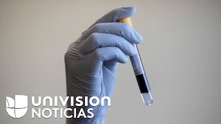 Así funciona la prueba de sangre que ayuda a la detección de ciertos tipos de cáncer recurrente [upl. by Osner]