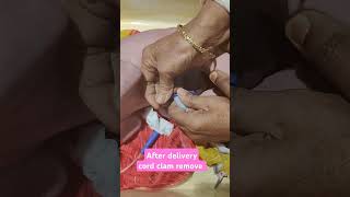 shortvideo after delivery cord clam remove [upl. by Adaven50]