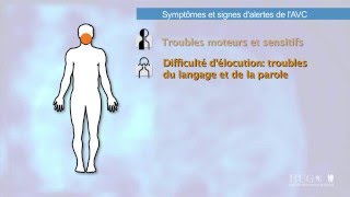 Symptômes et signes dalerte de lAVC [upl. by Assila]