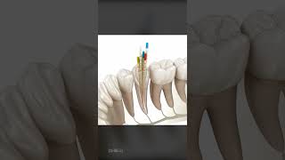 What To Expect During a Root Canal Is It Right For You [upl. by Ulda]