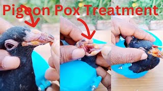 Pigeon Pox Treatment S  7 [upl. by Myrtice]