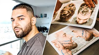 Meine Haartransplantation in der Türkei 🇹🇷 Ergebnisse nach 3 Jahren  Vorher amp Nachher [upl. by Leila]