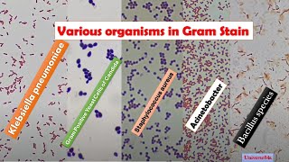 KlebsiellaStaphylococcusE coli CandidaAcinetobacterBacillus in Gram stain Under the Microscope [upl. by Meyer1]