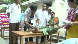 BioSurgery  Medicinal Leech Therapy  Nadipathy  Kakinada [upl. by Kele961]