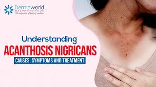 Understanding Acanthosis Nigricans Causes Symptoms and Treatment [upl. by Docilla106]