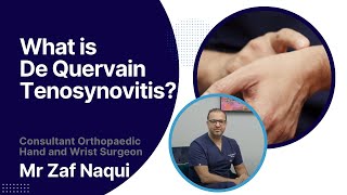 What is De Quervain tenosynovitis [upl. by Elsa]