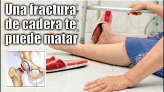 Podrías MORIR por una FRACTURA de CADERA 👵🏻 Diagnóstico y Tratamiento ⭐ Dr EDSON SERRANO Neomedica [upl. by Sophey702]