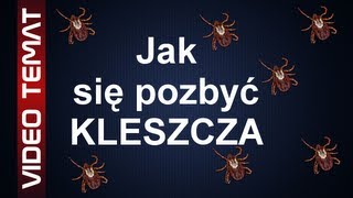 Jak usunąć kleszcza  Skuteczne sposoby na kleszcze [upl. by Ydahs]