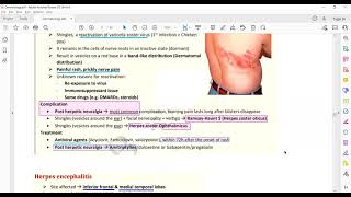 Plab 1 Lectures Dermatology Part 8 Herpes SimplexHerpes ZosterMolluscum Contagiousm [upl. by Suillenroc330]