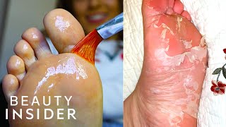 How A Chemical Peel Exfoliates Your Feet  Beauty Explorers [upl. by Aenal]