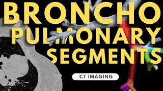 Segmental anatomy of the lung  Radiology anatomy part 1 prep  Bronchopulmonary segments on CT [upl. by Olympium]