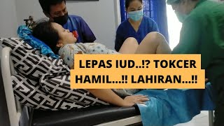 TOKCER LEPAS IUD HAMIL LAHIRANPART 2 [upl. by Balough]