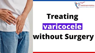 Varicocele Treatment  Treating Varicocele Without Surgery in Hyderabad [upl. by Ronym]