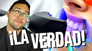 ¡LO QUE NADIE TE DICE 🚫 DEL BLANQUEAMIENTO DENTAL 💔 Deberías ver este vídeo 👀 [upl. by Malita54]