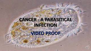 VIDEO PROOF CANCER IS CAUSED BY PARASITES [upl. by Atis]