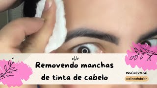 COMO REMOVER MANCHAS DE TINTA DE CABELO NA TESTA [upl. by Eirased667]