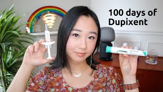 100 days of Dupixent  eczema update [upl. by Einitsed716]