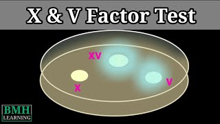 X amp V Factor Test  X V XV Factor Test For Haemophilus Influenzae [upl. by Karab]