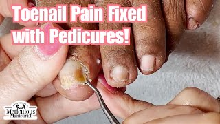 Toenail Cleaning Fixes Pain in Big Toe after Years of Discomfort [upl. by Ilaire]