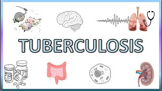 Tuberculosis  Types Pathogenesis Signs and Symptoms Diagnosis Treatment and Prevention [upl. by Stiegler]