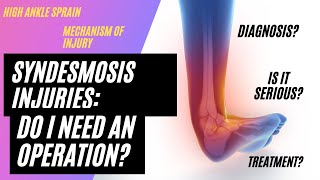 Syndesmosis Injury High Ankle Sprains [upl. by Tyrus366]