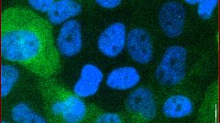 Mitotic catastrophe triggered in human cancer cells by the viral protein apoptin  movie A [upl. by Nettirb924]