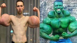 Biggest Synthol Freaks Of 2023 Best Oil Guys Of 2023 13 [upl. by Kinom]