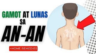 GAMOT at LUNAS sa ANAN  Mga Sanhi Sintomas at Paano Mawawala Home Remedies Creams [upl. by Lebanna]